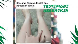 Download lagu HERBASKIN NATURAL BRIGHTENING (Testimoni) mp3 Download lagu HERBASKIN NATURAL BRIGHTENING (Testimoni) mp3
