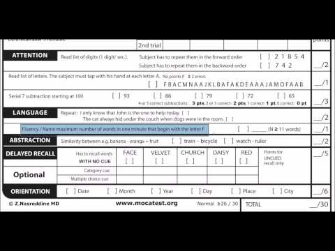 Administration of the Montreal Cognitive Assessment