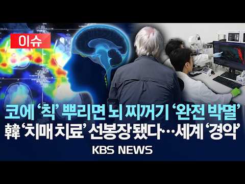 코에 '칙' 뿌리면 뇌 찌꺼기 '박멸'/한국 '치매 치료' 선봉장 됐다…세계 '경악'/2026년 8월 2일(…