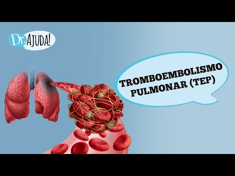TROMBOEMBOLISMO PULMONAR (TEP):O QUE É?  SINTOMAS E PREVENÇÃO