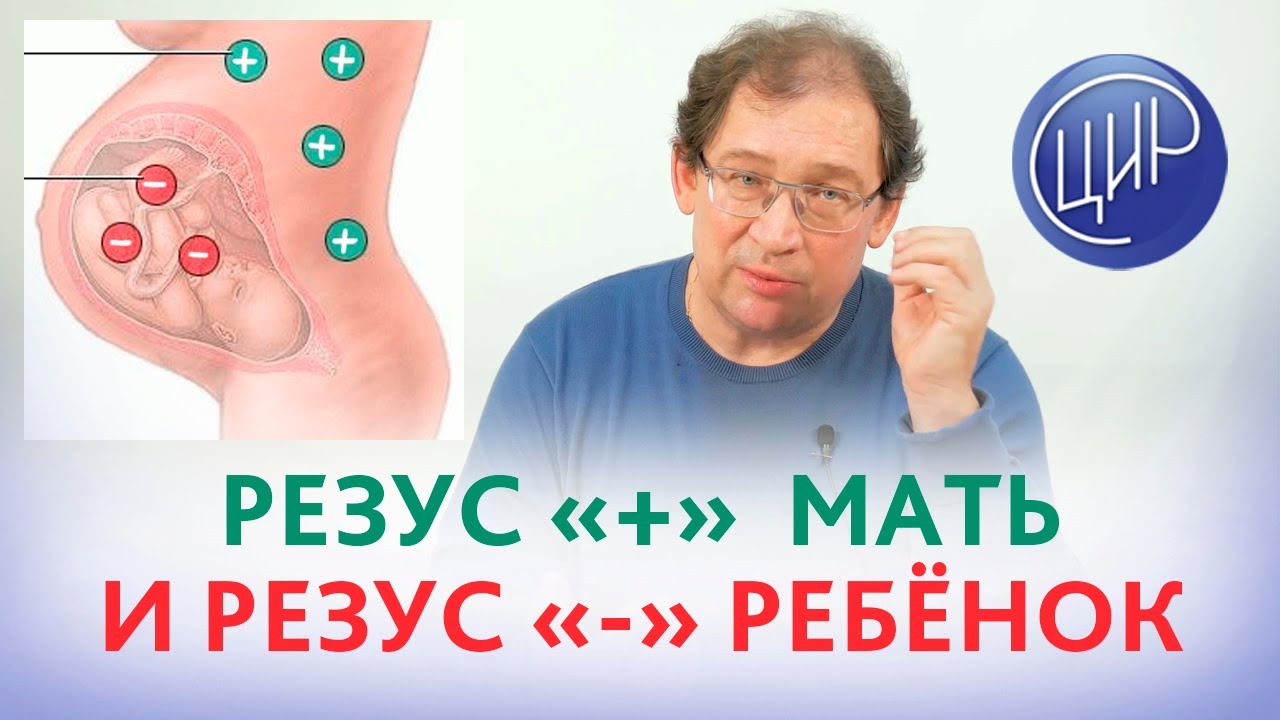 Резус-положительная мать и резус-отрицательный отец. Может ли быть резус-конфликт при беременности