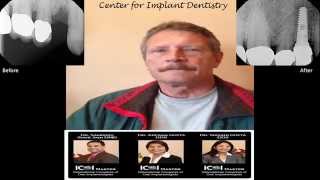 Advanced Implantology Bay Area - Center for Implant Dentistry