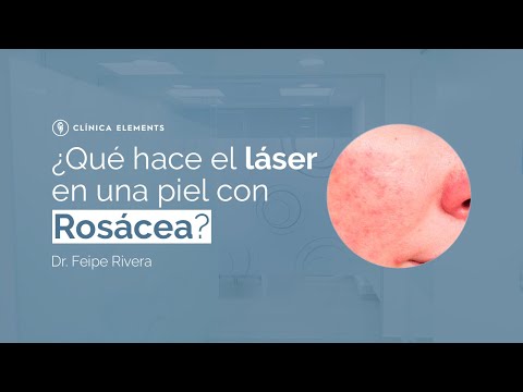 ¿Qué hace el láser en una piel con rosácea?