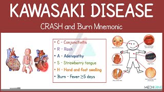 Kawasaki Disease Explained | CRASH and Burn Mnemonic for Nursing and Medical Students