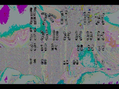 2AM 2AM 2AM 2AM 2AM KKKKKKKKKKKKKKK pa pa pa