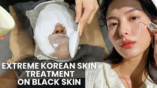 Getting the MOST POPULAR Korean Skin Clinic Treatment *RESULTS* 🇰🇷 #koreanskinclinic