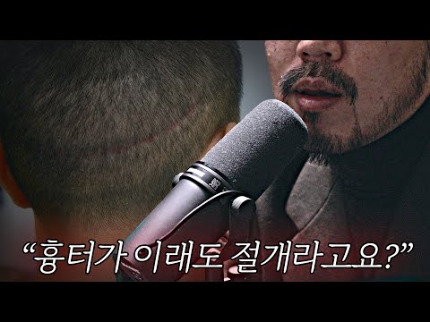 절개 모발이식 '흉터가 문제?' 모발이식 의사들은 다 알면서도 비절개를 한다