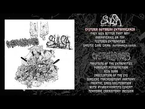 Sulsa / Cystoblastosis - split CS FULL ALBUM (2018 - Goregrind)
