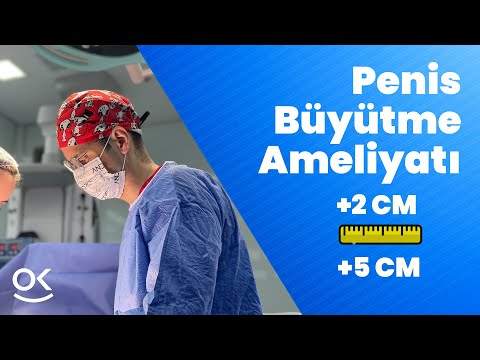 Penis Büyütme Ameliyatı +5 cm
