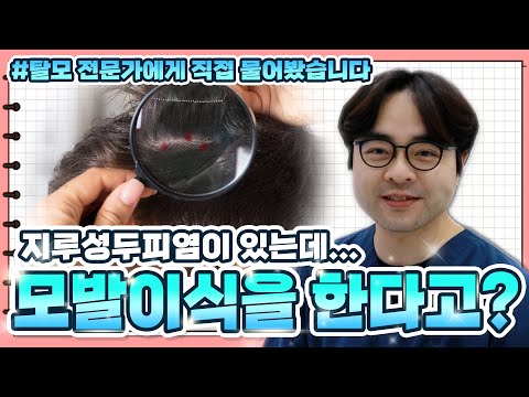 [구원장님] 지루성 두피염있는데 모발이식 가능한가요? #광주모발이식