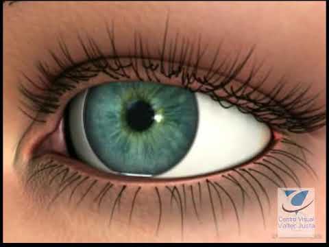 Centro Visual Valter Justa - O que é astigmatismo?