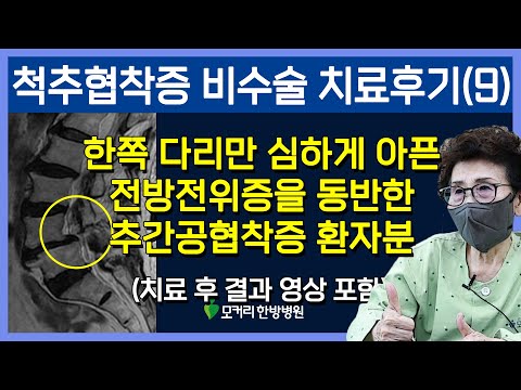 치료후기사진 입니다.