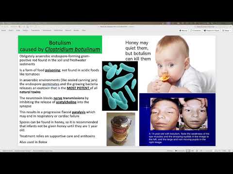 Bacterial Diseases of the Nervous System | BIO 220 Lectures