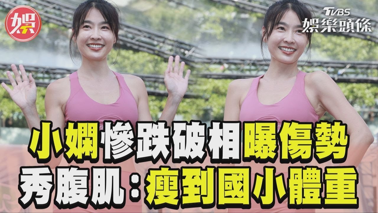 小嫻「摔裂下巴」首亮相曝光傷勢! 秀驚人川字肌真實身材:瘦到國小體重