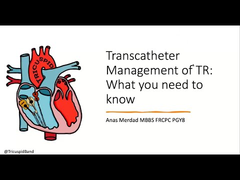 Transcatheter Management of Tricuspid Regurgitation - What You Need to Know