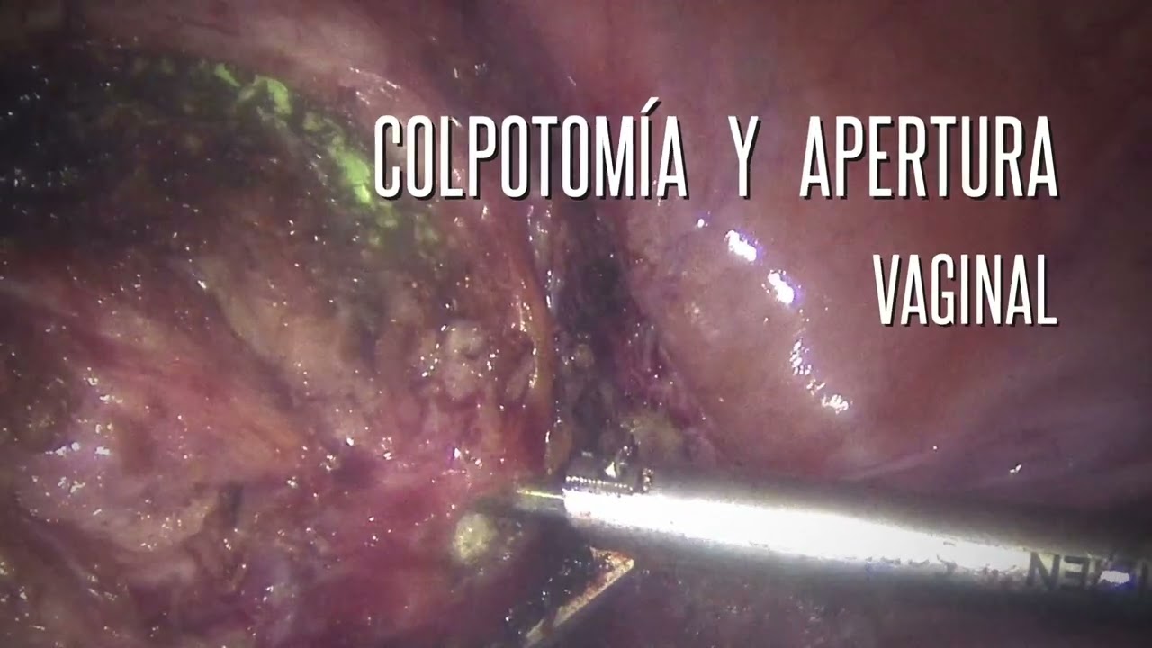 Ángel Millán Juárez-89