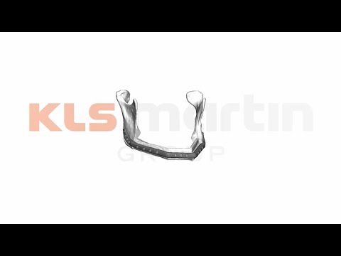 IPS Implants® Mandible Reconstruction Planning
