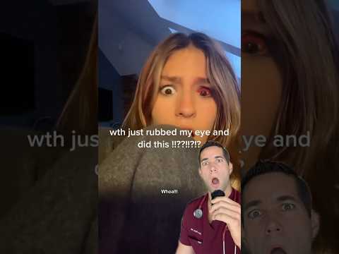 What happened to her eye?!