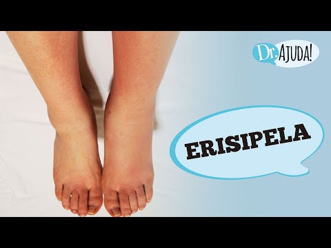 ERISIPELA: O QUE É, CAUSAS, SINTOMAS, DIAGNÓSTICO E TRATAMENTO