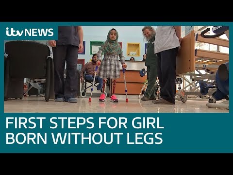 Doctor’s kindness sees girl born without legs takes her first steps on prosthetic limbs | ITV News