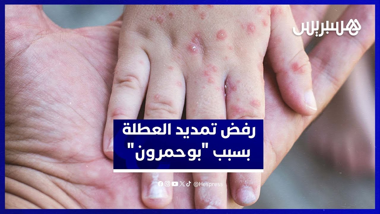 أولياء التلاميذ يعارضون تمديد العطلة للحد من انتشار "بوحمرون" thumbnail
