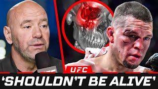 The Most BRUTAL Injuries In The UFC..