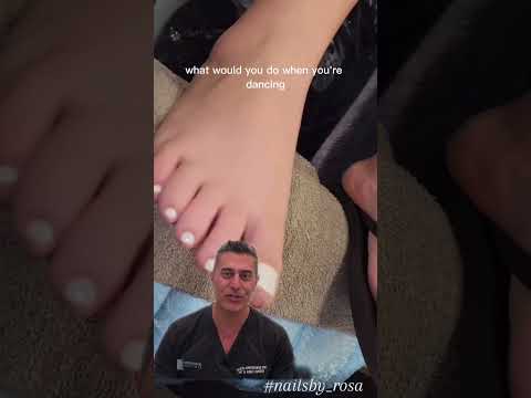 Clever Way to Hide Toenail Fungus
