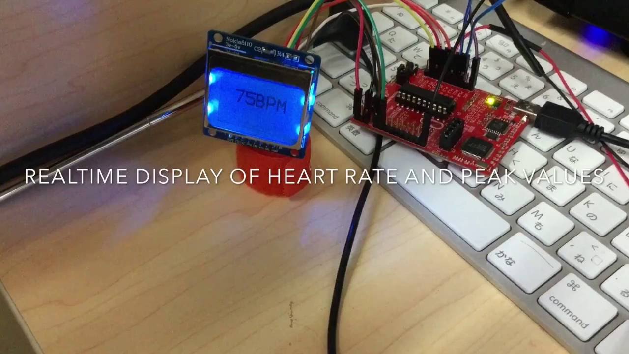 Wavelet-based Adaptive ECG Feature Extraction