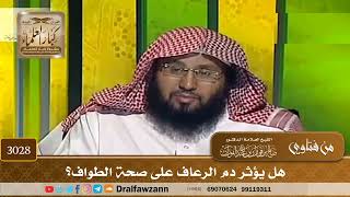 3028- هل يؤثر دم الرعاف على صحة الطواف؟ | الشيخ صالح الفوزان