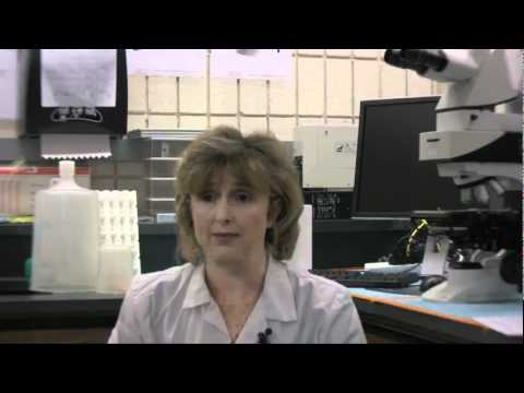 Dr. Eva Sapi - Boala Lyme - formele si subformele Borreliei Burgdorferi in vivo.flv