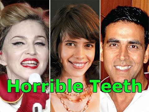 download lagu mp3 mp4 Bollywood Actresses With Bad Teeth, download lagu Bollywood Actresses With Bad Teeth gratis, unduh video klip Bollywood Actresses With Bad Teeth