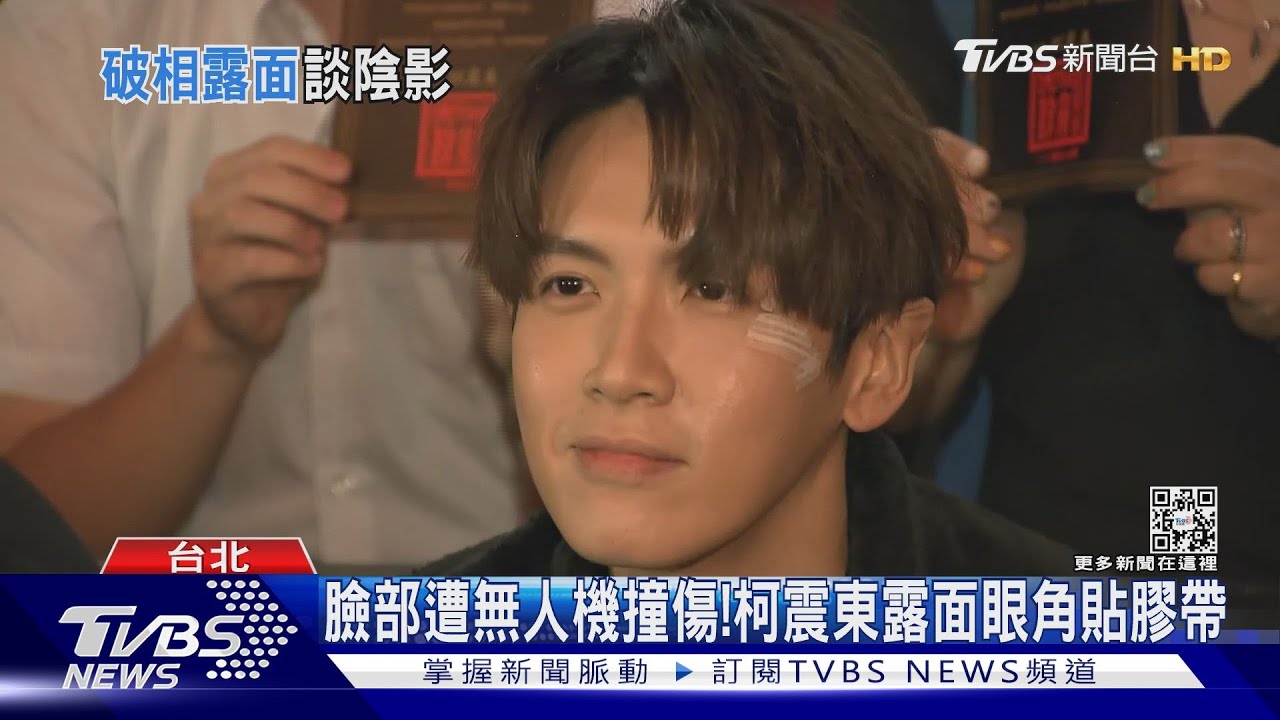 臉部遭無人機撞傷!柯震東公開露面「眼貼膠帶曝光」:還沒調適好