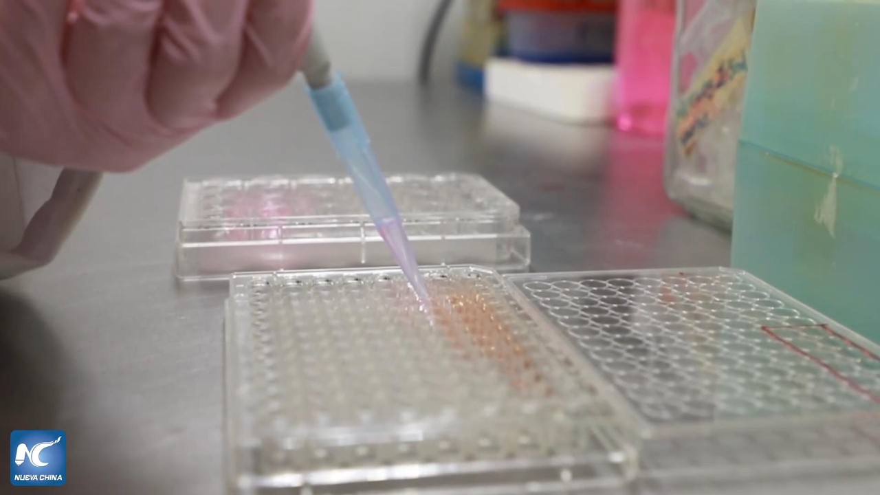 México desarrolla herramienta tecnológica que facilita detección temprana del Parkinson