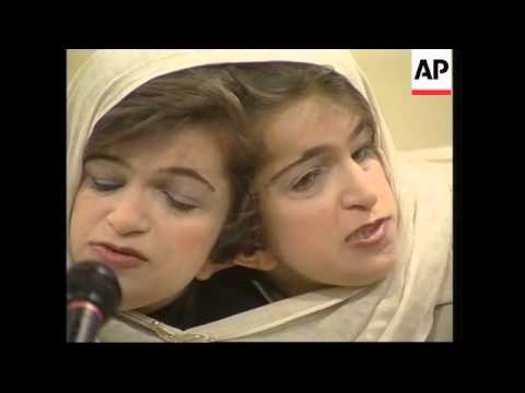 Twins say they're very excited to be having surgery