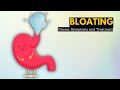 Bloating Causes Signs And Symptoms Diagnosis And Treatment