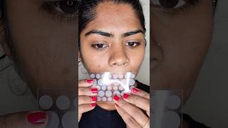 Pimple Patch Use Panalama 🙄😱| in tamil | @MissNithya |#missnithya #pimplepatch