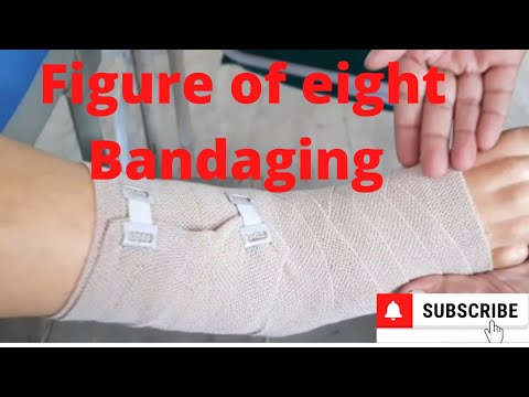 Achterverband-Anlegen durch PC-Pflegeverfahren