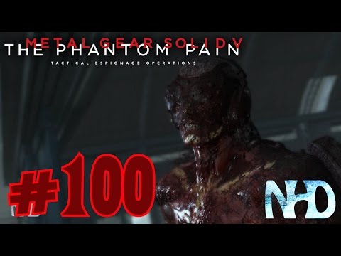 Let's Play Metal Gear Solid 5 The Phantom Pain (pt100) Metallic Archaea (Zombie Skulls)
