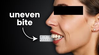 Why does your BITE feel Off? … Orthodontist explains