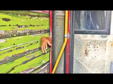 দুই বাসের বেপরোয়া গতিতে হাত হারালেন শিক্ষার্থী