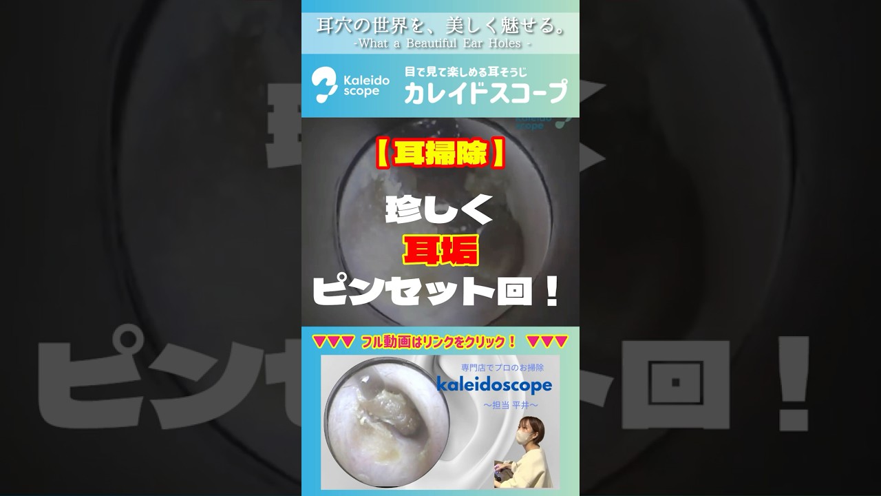【耳掃除】珍しく耳垢ピンセット回！