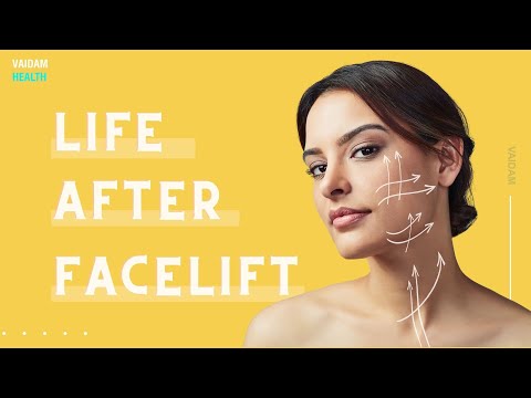 Life after Facelift