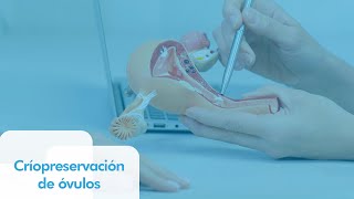 Criopreservación de óvulos