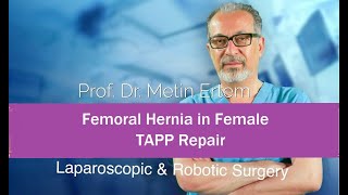 Miniaturka - Femoral Hernia TAPP Repair. Metin Ertem MD.FACS