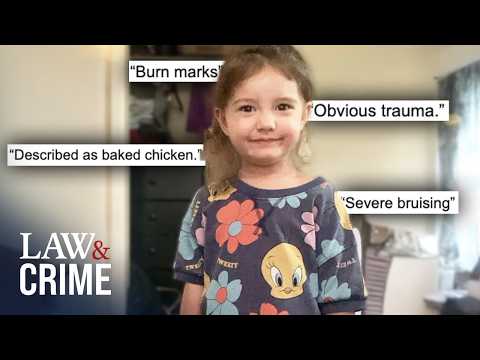 5-Year-Old Burned and Left to Die: Cops