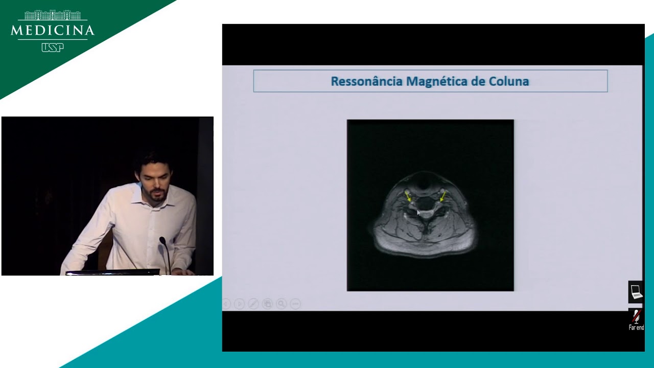 Erivelton Azevedo Lopes-0