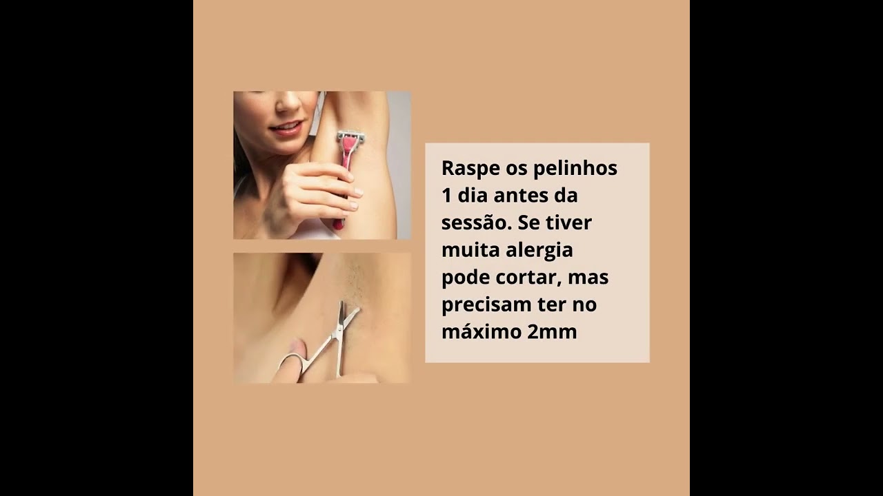 Preparação para depilação a laser ipl