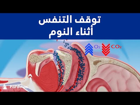 توقف التنفس أثناء النوم ©