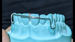 Download lagu Split Labial Bow fabrication with Indications | Orthodontics | Dental Occlusion mp3