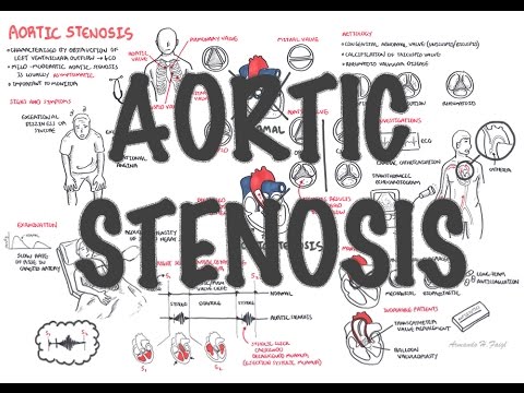 Aortic Stenosis Overview